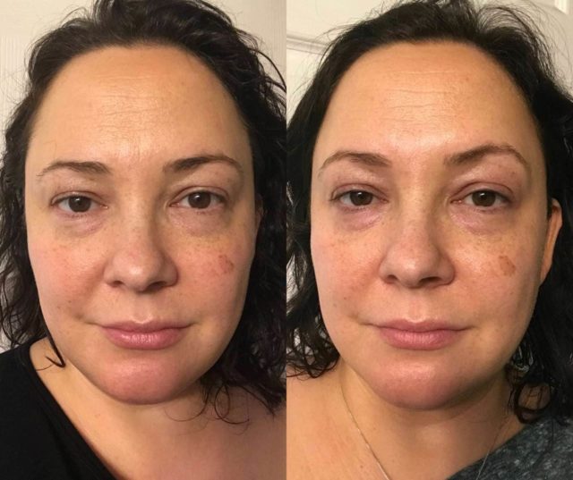 Neutrogena Rapid Wrinkle Repair Regenerating Cream review - before and after one week by Wardrobe Oxygen