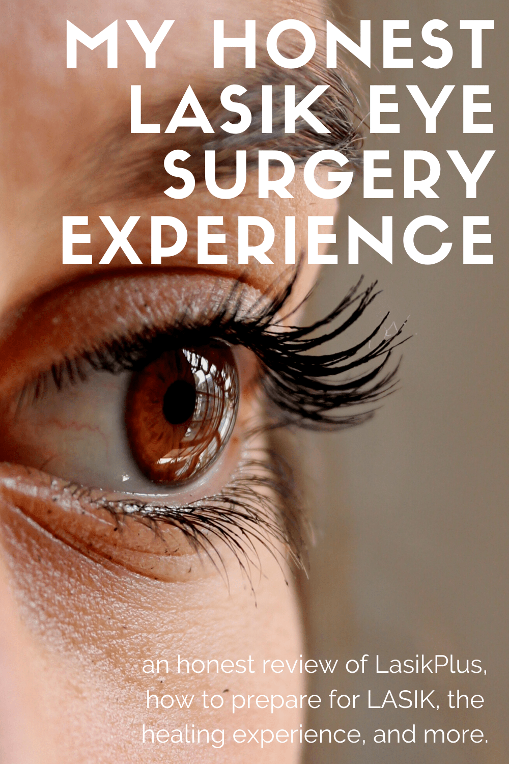 My LASIK Experience