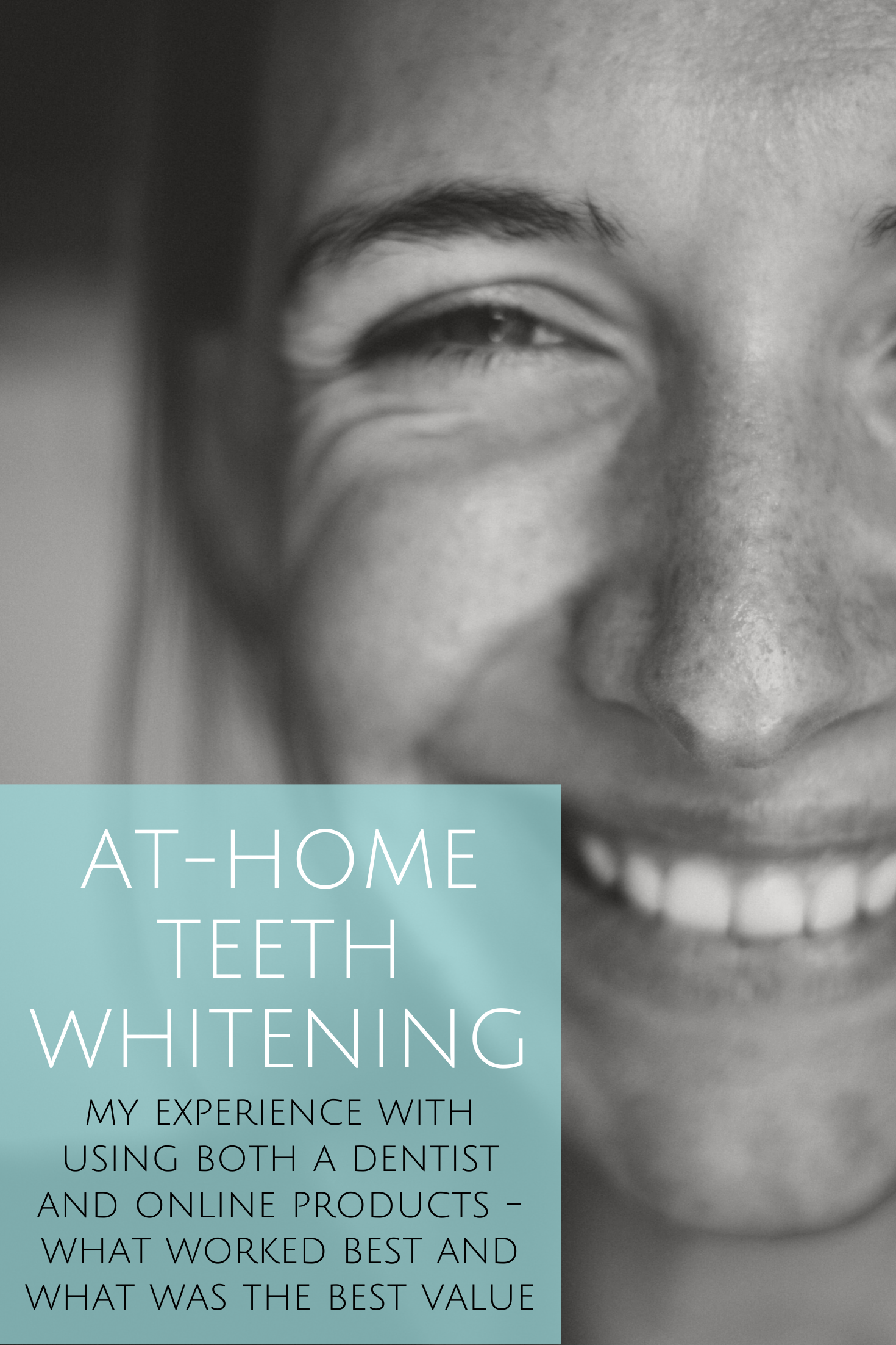 My At-Home Teeth Whitening Experience
