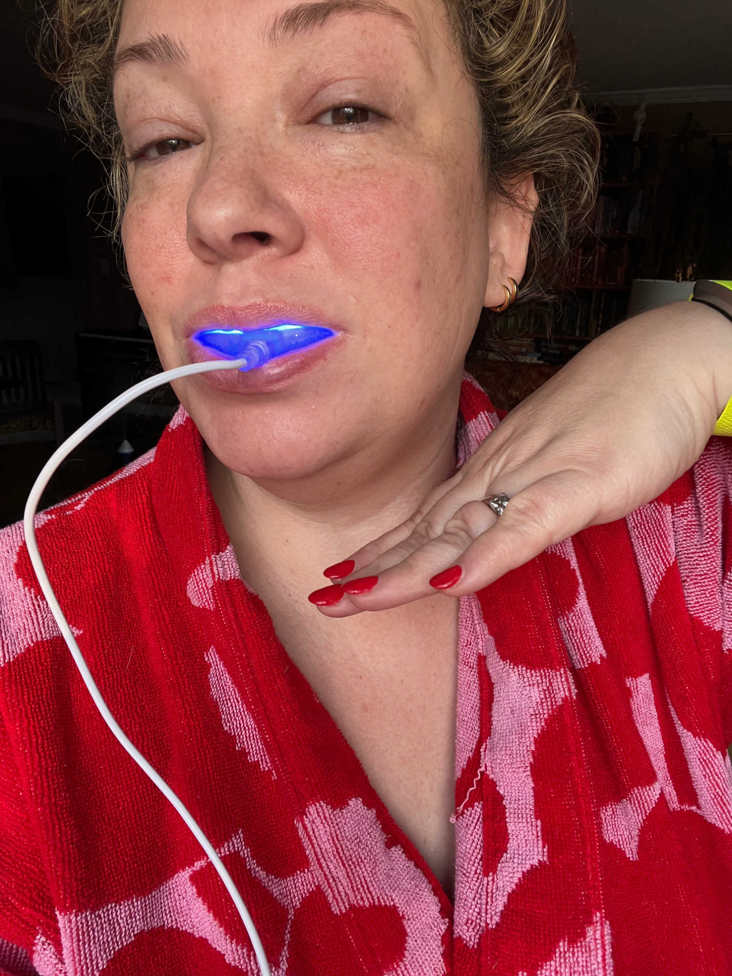 Shocking Revive Sky Lifestyle Teeth Whitening Review: Before & After Photos! - 7u3b4pe