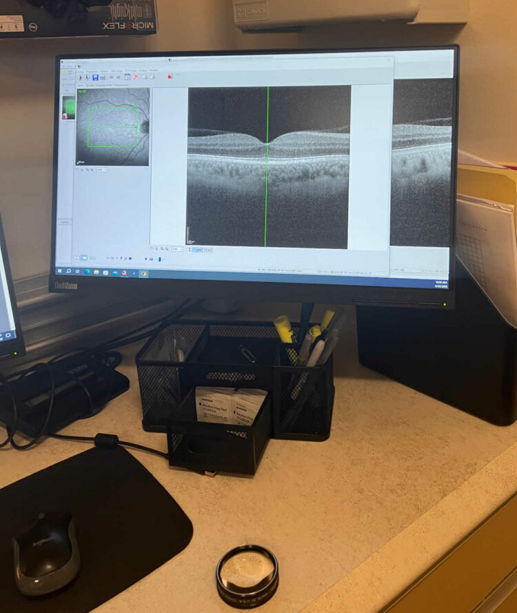 Eye checkup from a retina specialist